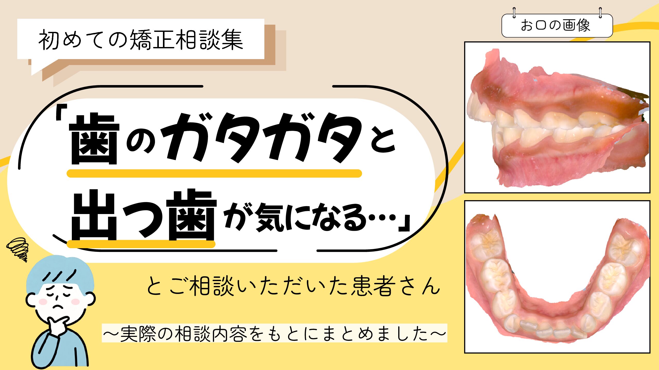 「歯のガタガタと出っ歯が気になる…」とご相談いただいたT.Iさん（8歳・男の子）のケース