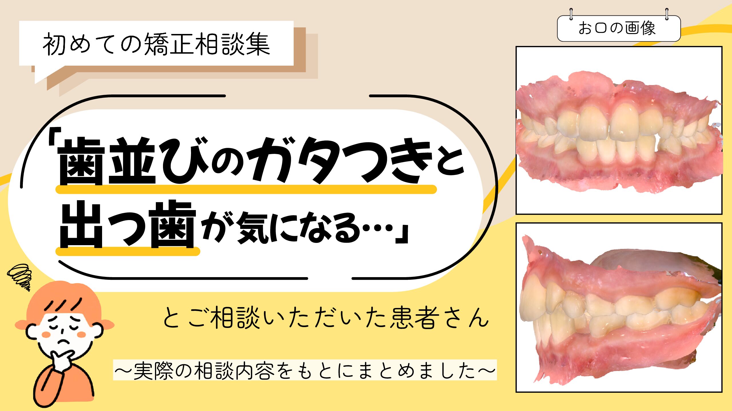 「歯並びのガタつきと出っ歯が気になる…」とご相談いただいた8歳・女の子のケース