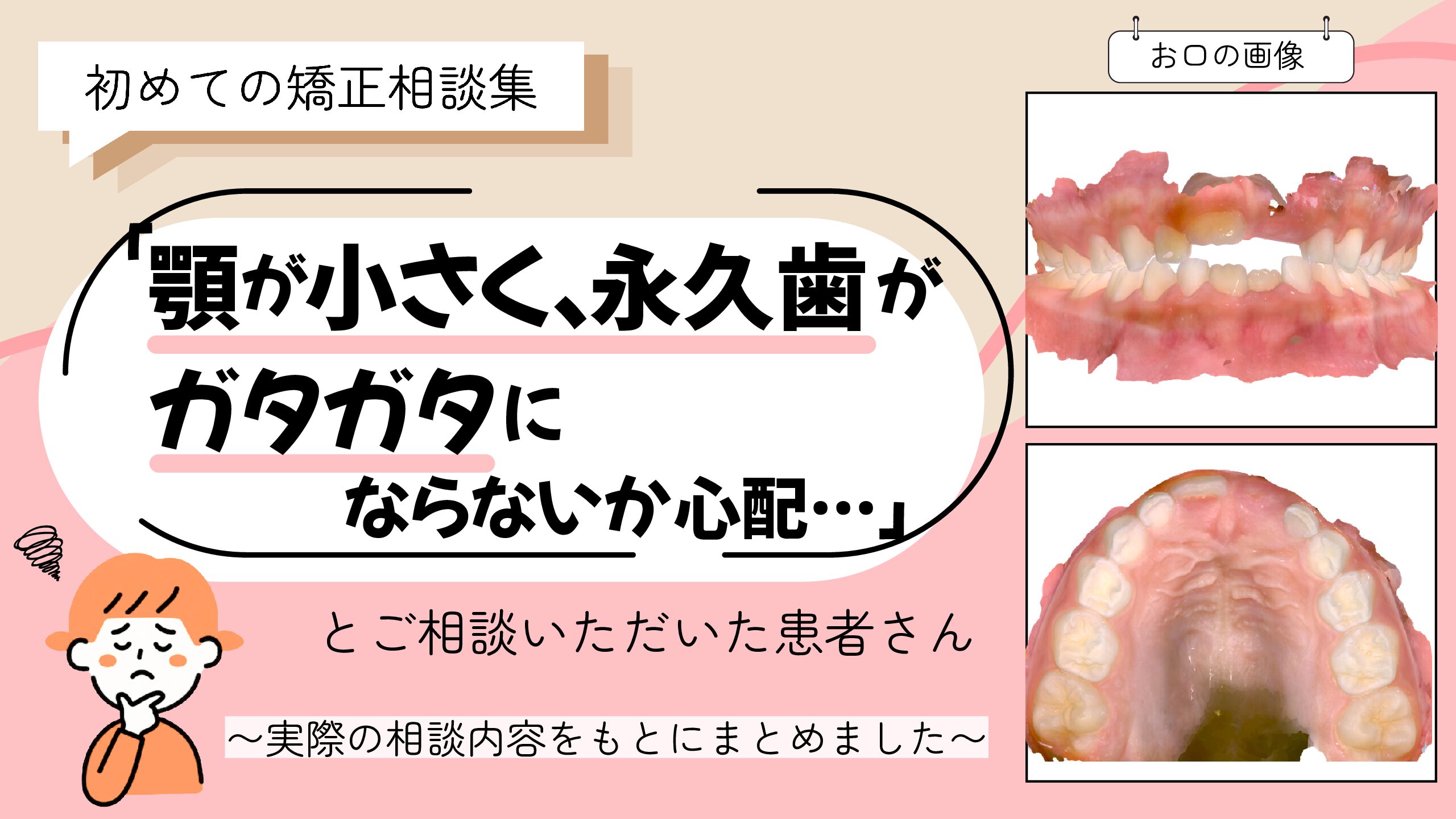 「顎が小さく、永久歯がガタガタにならないか心配…」とご相談いただいたI.Eさん（6歳・女の子）のケース