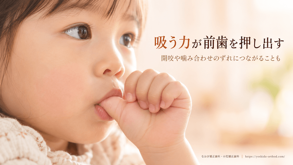 指しゃぶりで出っ歯になるのは本当?
