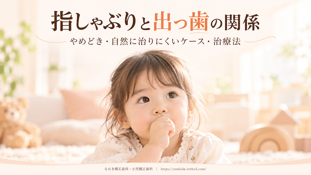 指しゃぶりで出っ歯になる?何歳までにやめれば治るのか、自然に治らないケースと治療法を矯正認定医が解説